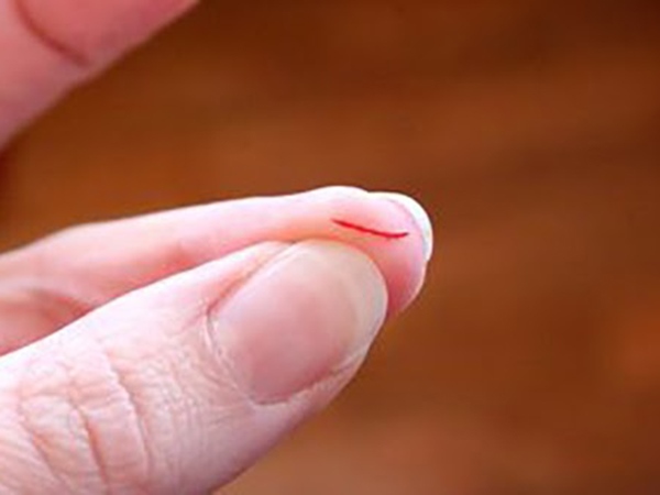 Nằm mơ thấy đứt tay chảy máu có điềm gì, đen hay đỏ?